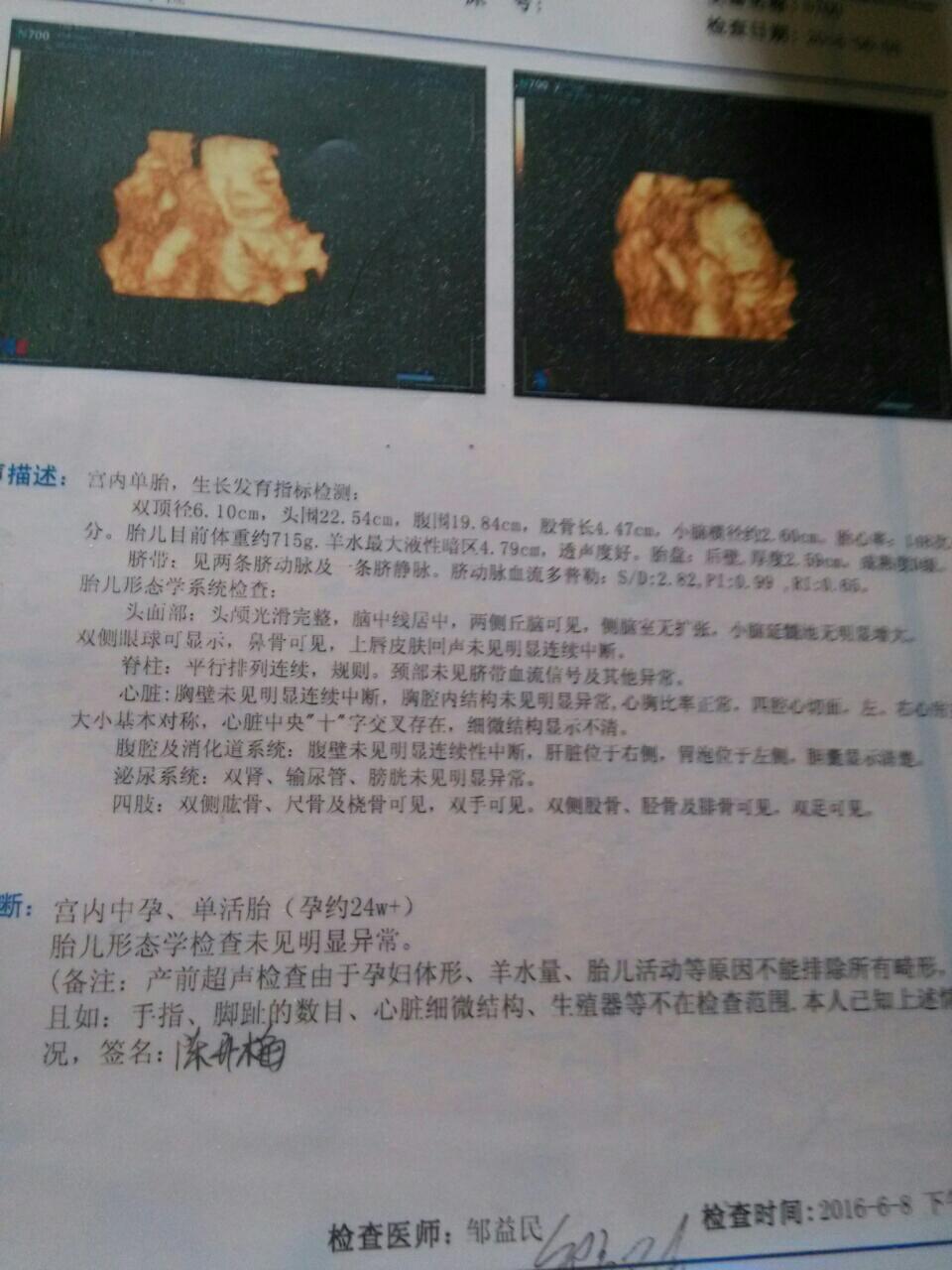 关于两个月能否确定胎儿性别的探讨